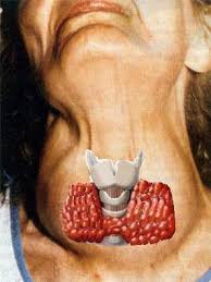 Tiroide con cancro